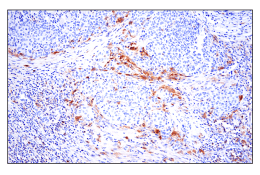 Immunohistochemistry Image 8: Phospho-SLP-76 (Ser376) (E3G9U) XP® Rabbit mAb (BSA and Azide Free)