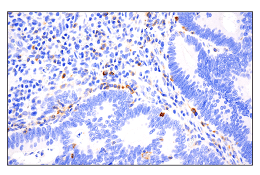 Immunohistochemistry Image 2: Phospho-SLP-76 (Ser376) (E3G9U) XP® Rabbit mAb (BSA and Azide Free)