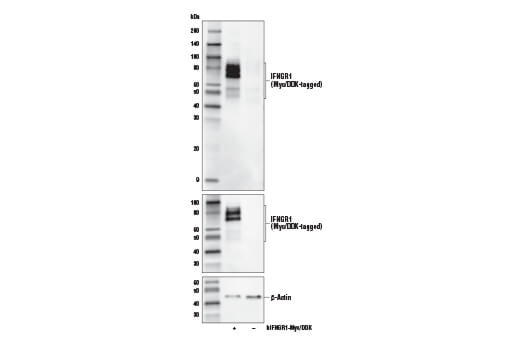 Western Blotting Image 2: IFNGR1 (E444) Antibody