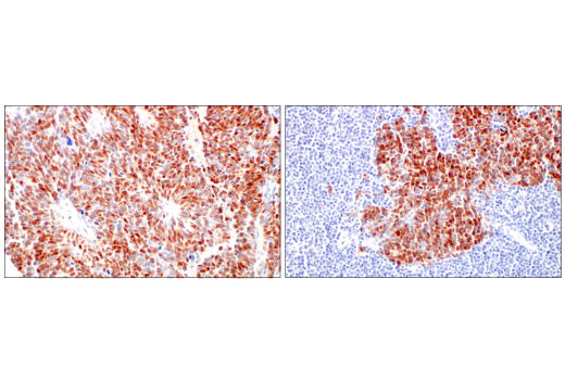  Image 45: Small Cell Lung Cancer Biomarker Antibody Sampler Kit