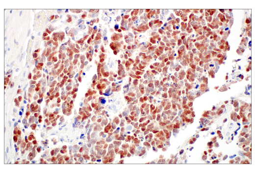  Image 39: Small Cell Lung Cancer Biomarker Antibody Sampler Kit