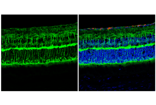 Immunofluorescence Image 1: EAAT2 (E3P5K) Rabbit mAb (Alexa Fluor® 488 Conjugate)