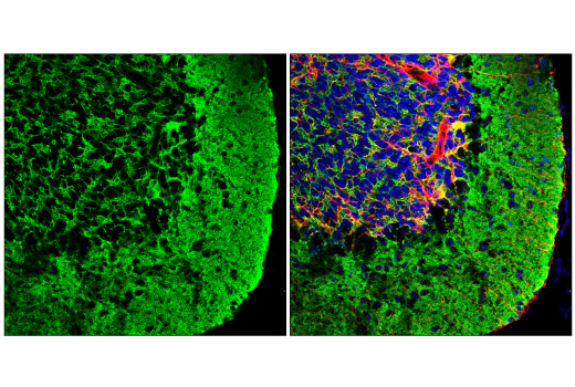 Immunofluorescence Image 2: EAAT2 (E3P5K) Rabbit mAb (Alexa Fluor® 488 Conjugate)