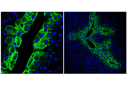 Immunofluorescence Image 3: EAAT2 (E3P5K) Rabbit mAb (Alexa Fluor® 488 Conjugate)