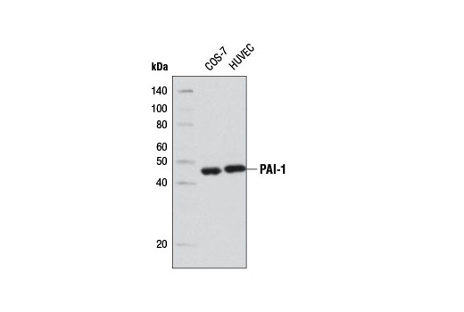 Western Blotting Image 1: PAI-1 (D9C4) Rabbit mAb