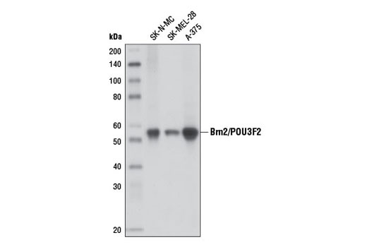 Western Blotting Image 1: Brn2/POU3F2 (D2C1L) Rabbit mAb