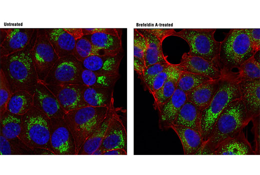  Image 17: ER and Golgi-Associated Marker Proteins Antibody Sampler Kit