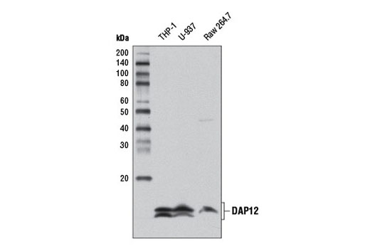  Image 6: TREM2 Signaling Pathways Antibody Sampler Kit