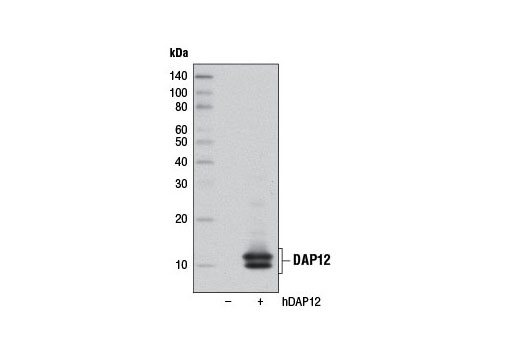  Image 16: TREM2 Signaling Pathways Antibody Sampler Kit