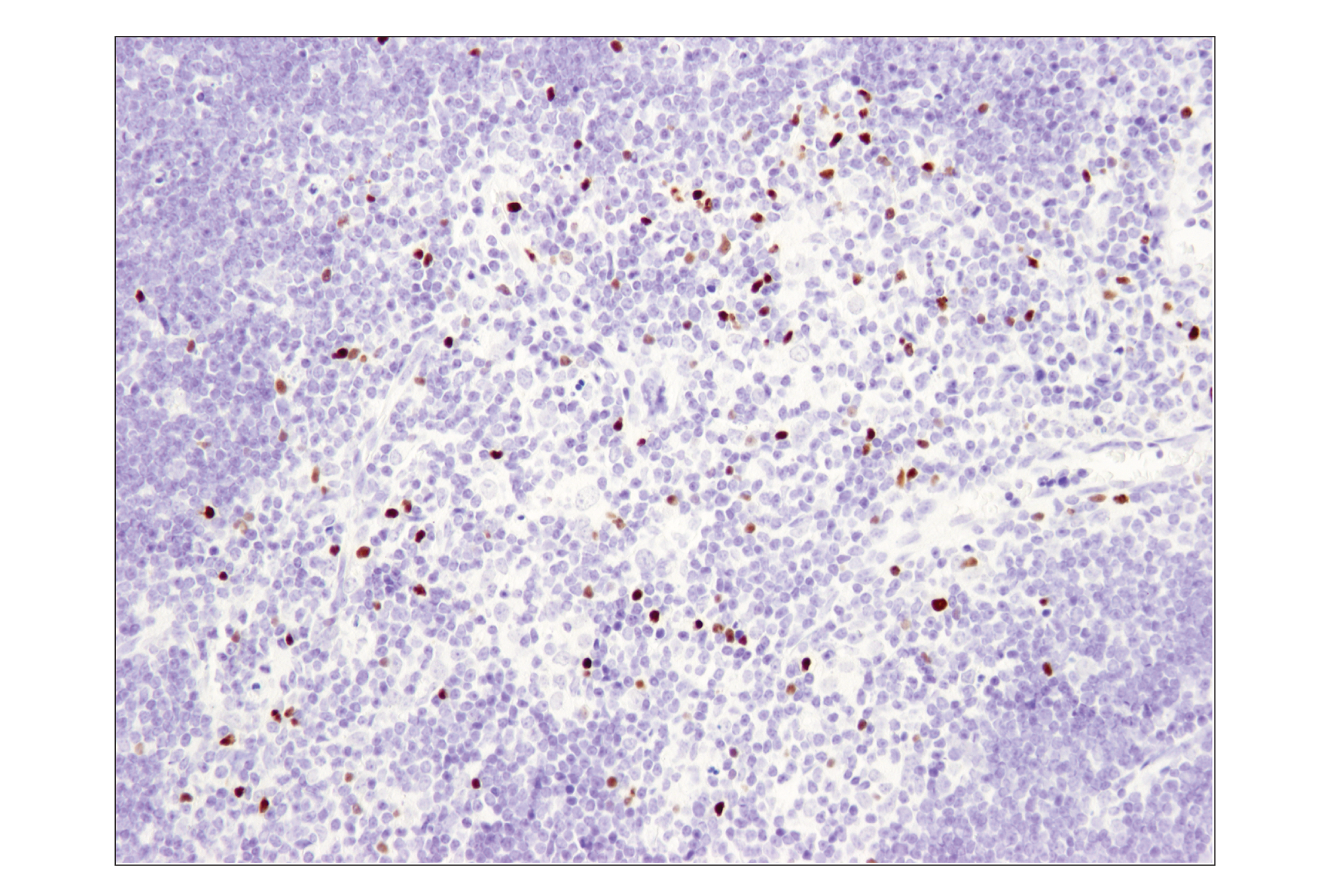 Immunohistochemistry Image 2: FoxP3 (D6O8R) Rabbit mAb