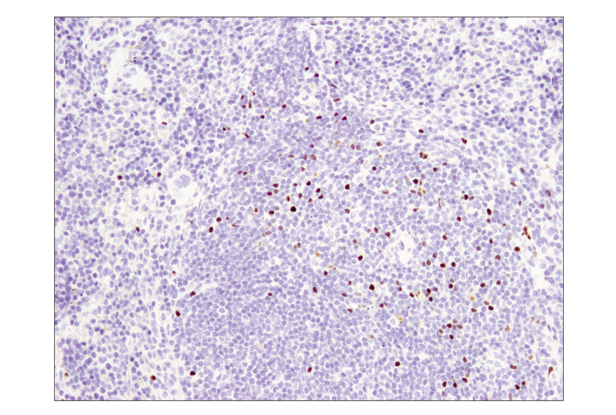  Image 17: Mouse Immune Cell Phenotyping IHC Antibody Sampler Kit