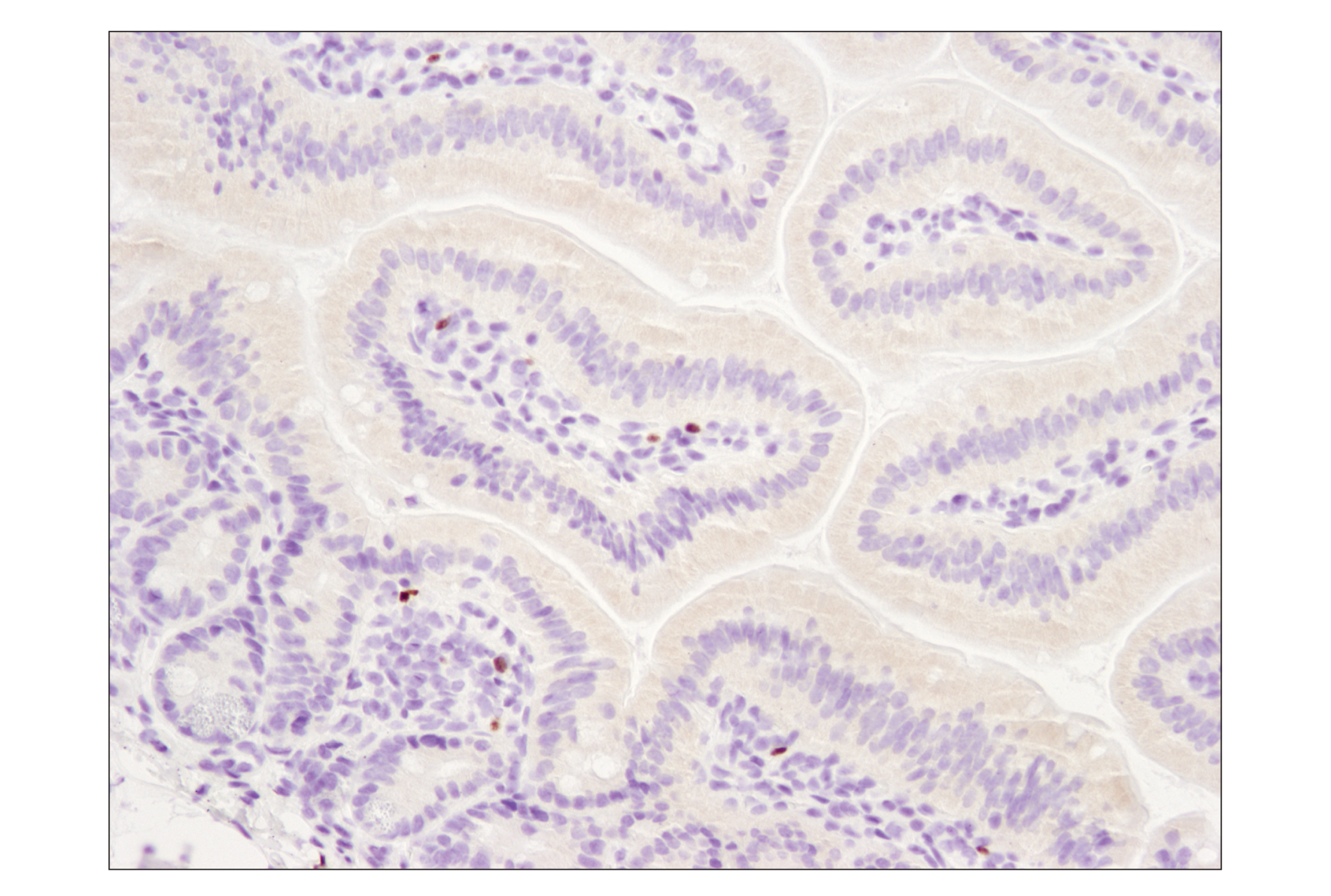  Image 25: Mouse Immune Cell Phenotyping IHC Antibody Sampler Kit