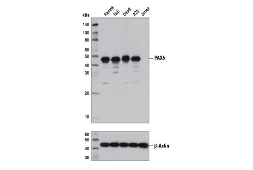 Western Blotting Image 1: PAX5 (D7H5X) XP® Rabbit mAb