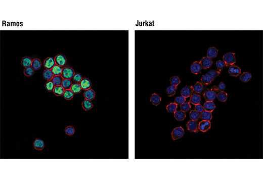 Immunofluorescence Image 1: PAX5 (D7H5X) XP® Rabbit mAb
