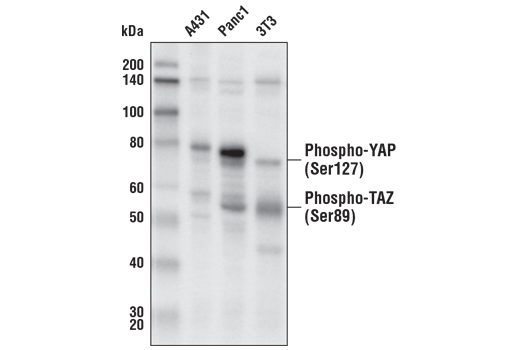 Western Blotting Image 4: Phospho-YAP (Ser127) (D9W2I) Rabbit mAb