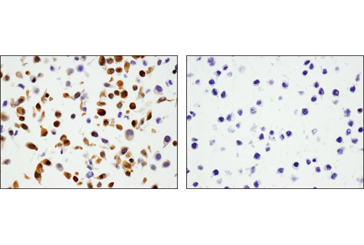 Immunohistochemistry Image 2: Phospho-YAP (Ser127) (D9W2I) Rabbit mAb