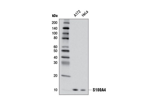 Image 8: Cancer Associated Fibroblast Marker Antibody Sampler Kit