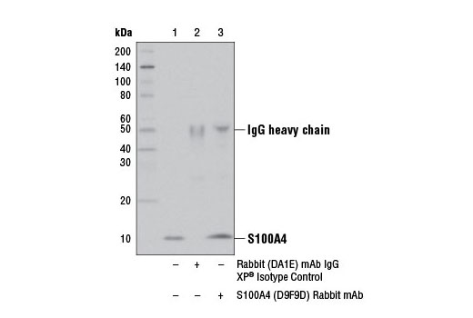  Image 16: Cancer Associated Fibroblast Marker Antibody Sampler Kit