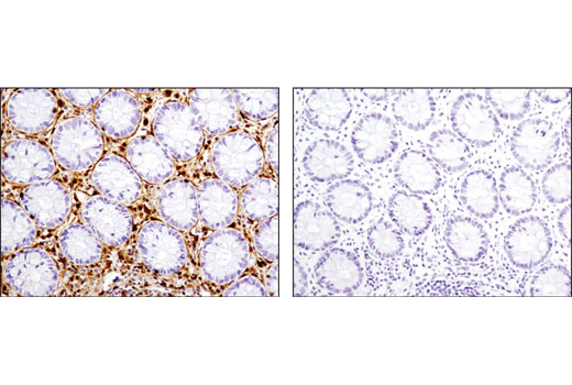  Image 23: Cancer Associated Fibroblast Marker Antibody Sampler Kit