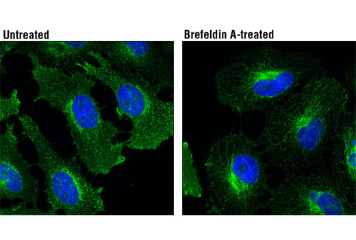 Immunofluorescence Image 1: CD71 (D7G9X) XP® Rabbit mAb