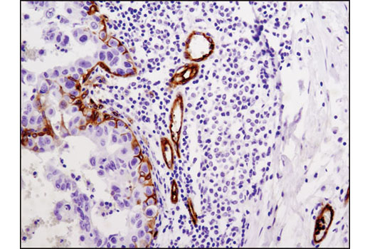 Immunohistochemistry Image 1: Integrin β3 (D7X3P) XP® Rabbit mAb