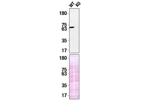  Image 18: TREM2 Signaling Pathways Antibody Sampler Kit