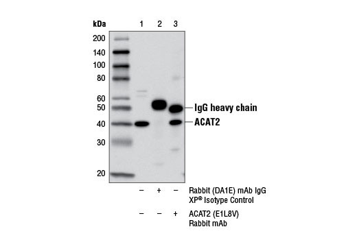 Immunoprecipitation Image 1: ACAT2 (E1L8V) Rabbit mAb