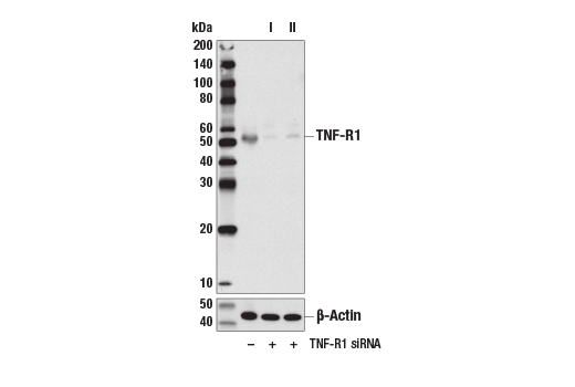 Western Blotting Image 2: TNF-R1 (D3I7K) Rabbit mAb