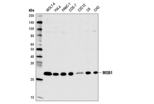  Image 4: Hippo Signaling Antibody Sampler Kit