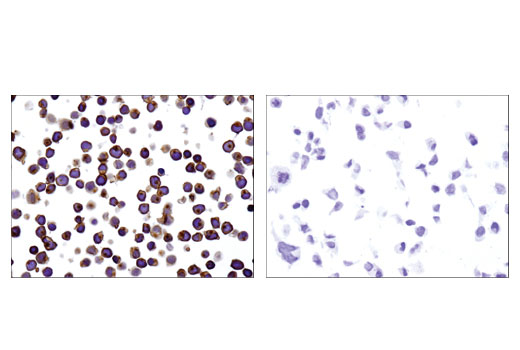 Immunohistochemistry Image 4: CD45 (Intracellular Domain) (D9M8I) XP® Rabbit mAb