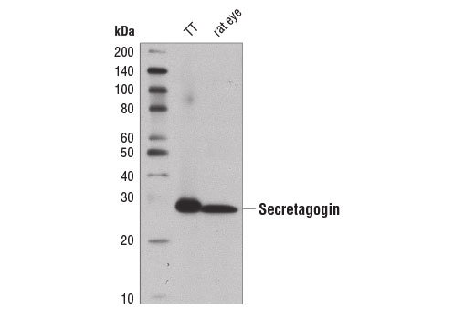 Western Blotting Image 1: Secretagogin (D4V1Y) XP® Rabbit mAb