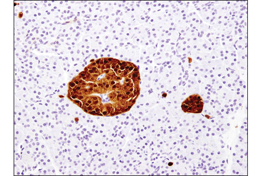 Immunohistochemistry Image 2: Secretagogin (D4V1Y) XP® Rabbit mAb