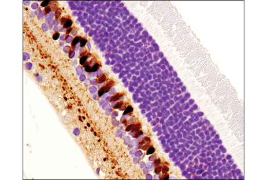 Immunohistochemistry Image 3: Secretagogin (D4V1Y) XP® Rabbit mAb