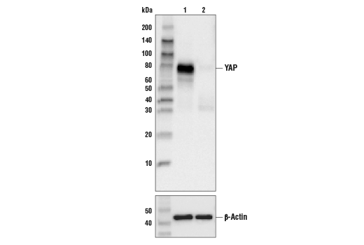  Image 9: Hippo Pathway: Upstream Signaling Antibody Sampler Kit