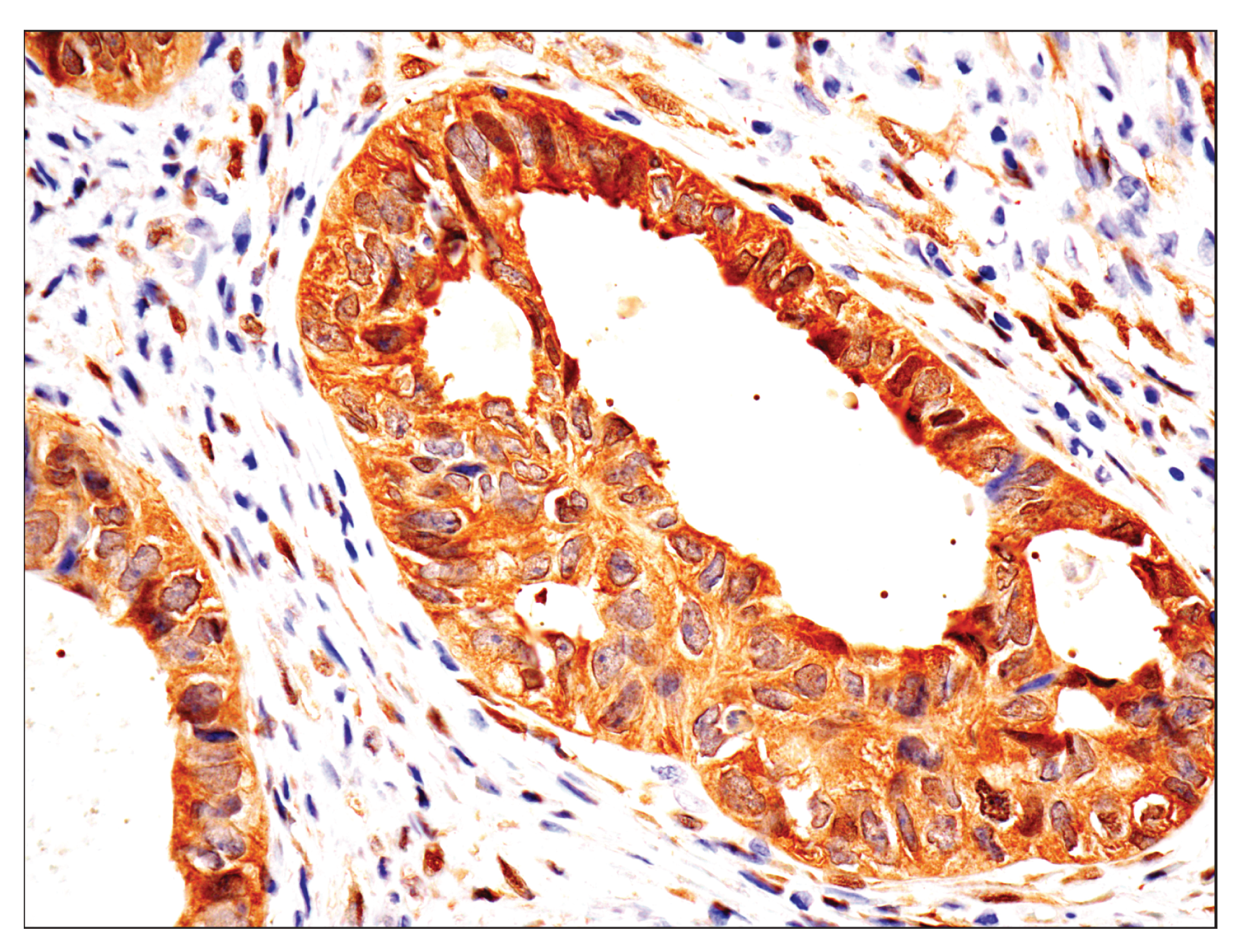  Image 46: Small Cell Lung Cancer Biomarker Antibody Sampler Kit