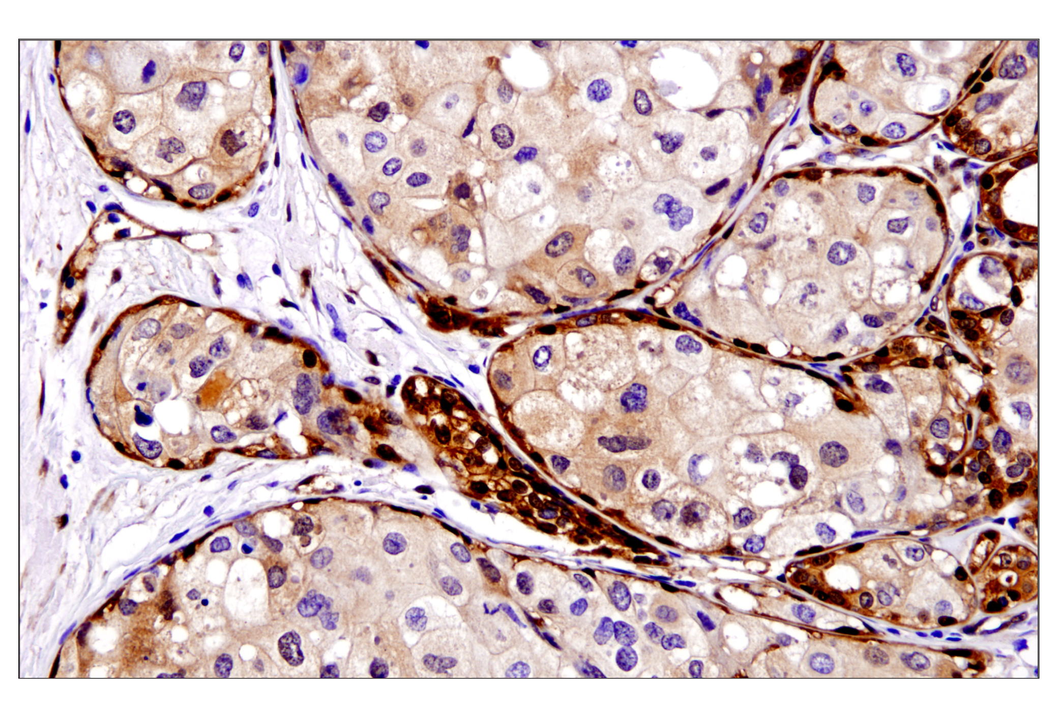  Image 57: Small Cell Lung Cancer Biomarker Antibody Sampler Kit