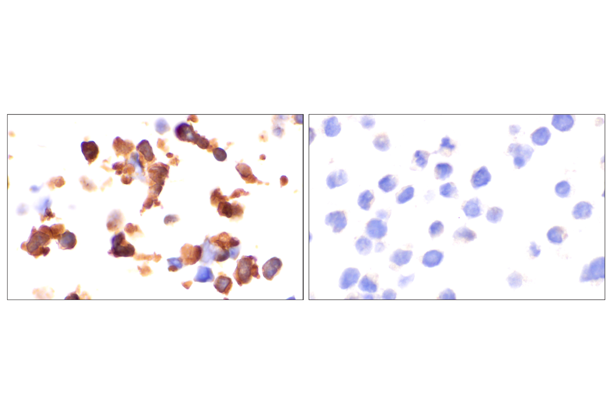  Image 76: Small Cell Lung Cancer Biomarker Antibody Sampler Kit