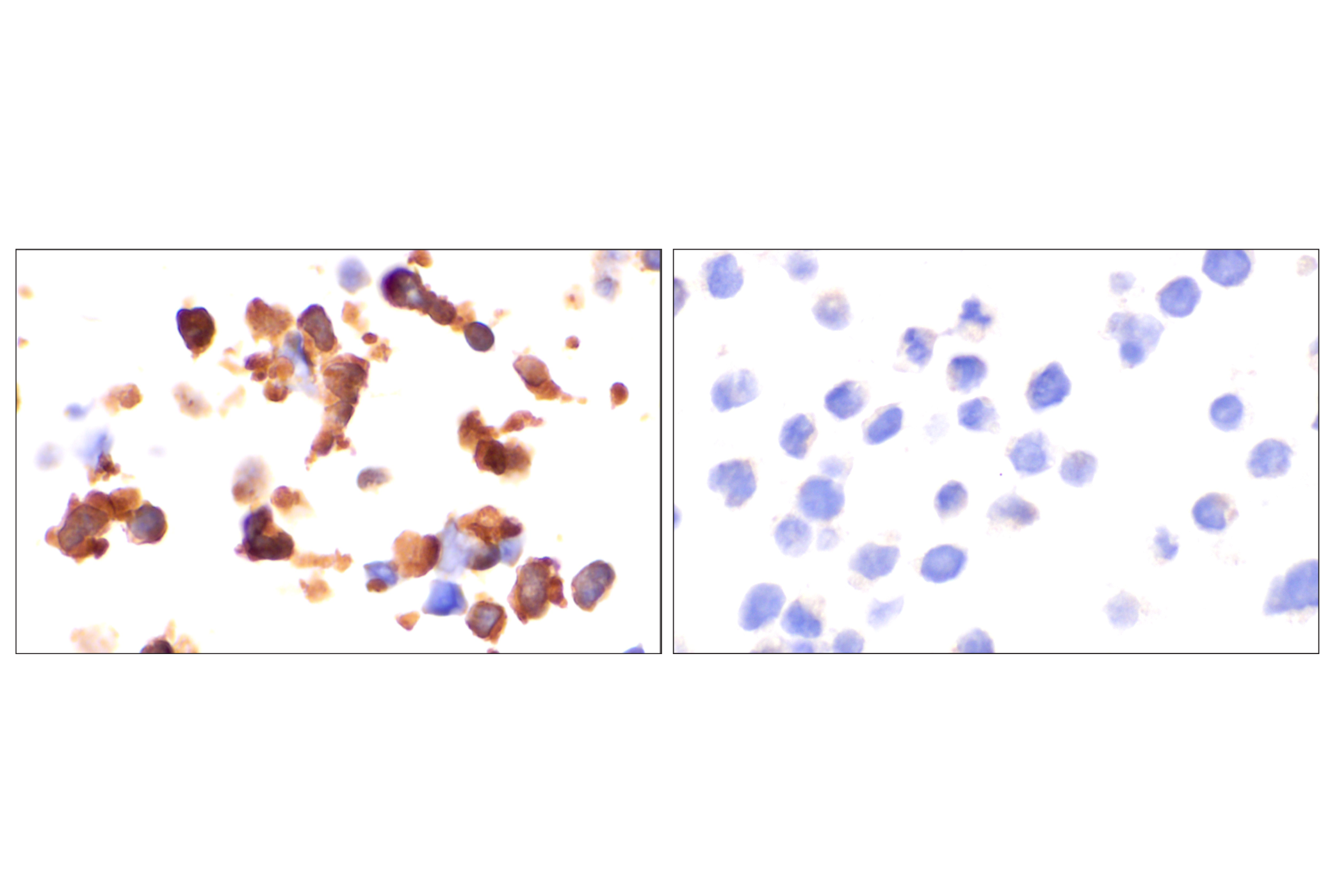  Image 22: PhosphoPlus® YAP (Ser109) Antibody Duet