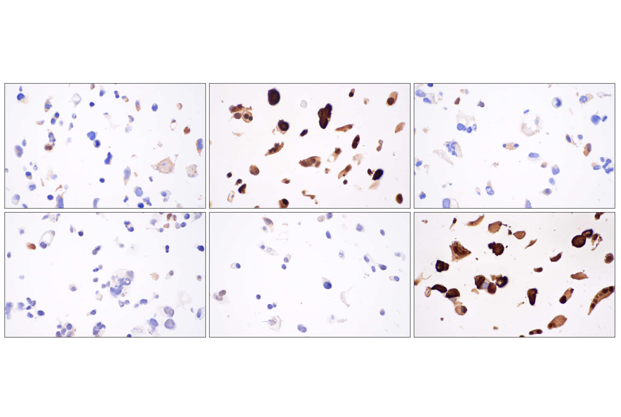  Image 33: Hippo Pathway: Upstream Signaling Antibody Sampler Kit