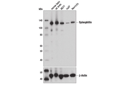 Western Blotting Image 1: Spinophilin (E1E7R) Rabbit mAb