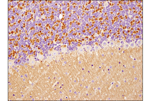 Immunohistochemistry Image 1: Spinophilin (E1E7R) Rabbit mAb