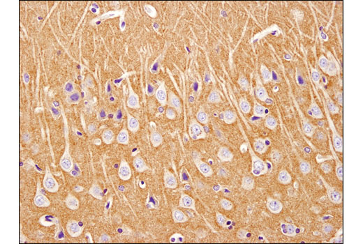 Immunohistochemistry Image 4: Spinophilin (E1E7R) Rabbit mAb