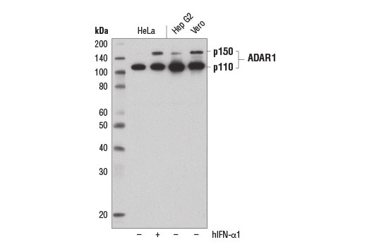 Western Blotting Image 1: ADAR1 (D7E2M) Rabbit mAb