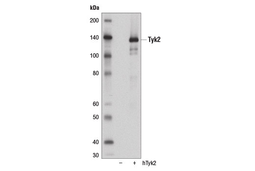 Image 18: IFN (Type I/III) Signaling Pathway Antibody Sampler Kit