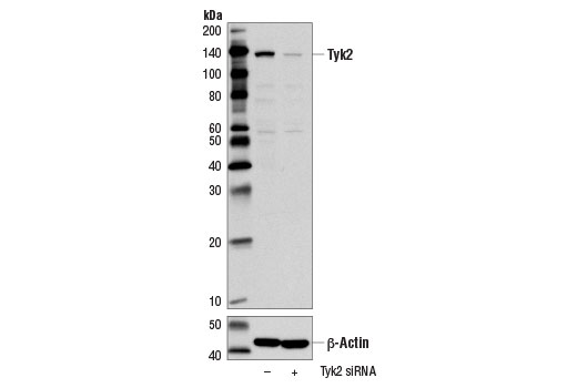  Image 27: IFN (Type I/III) Signaling Pathway Antibody Sampler Kit