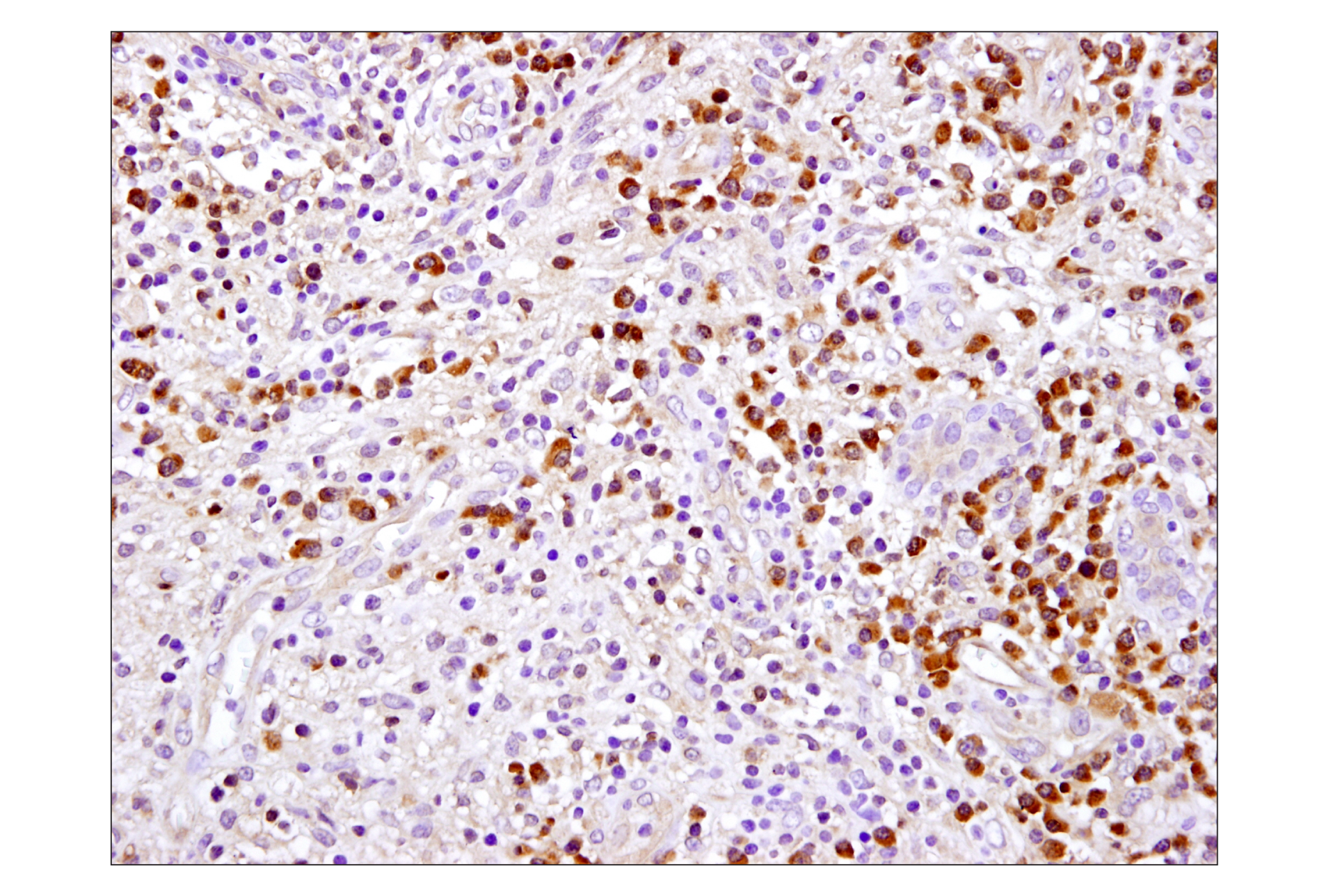 Immunohistochemistry Image 1: Caspase-3 (D3R6Y) Rabbit mAb (IHC Formulated)