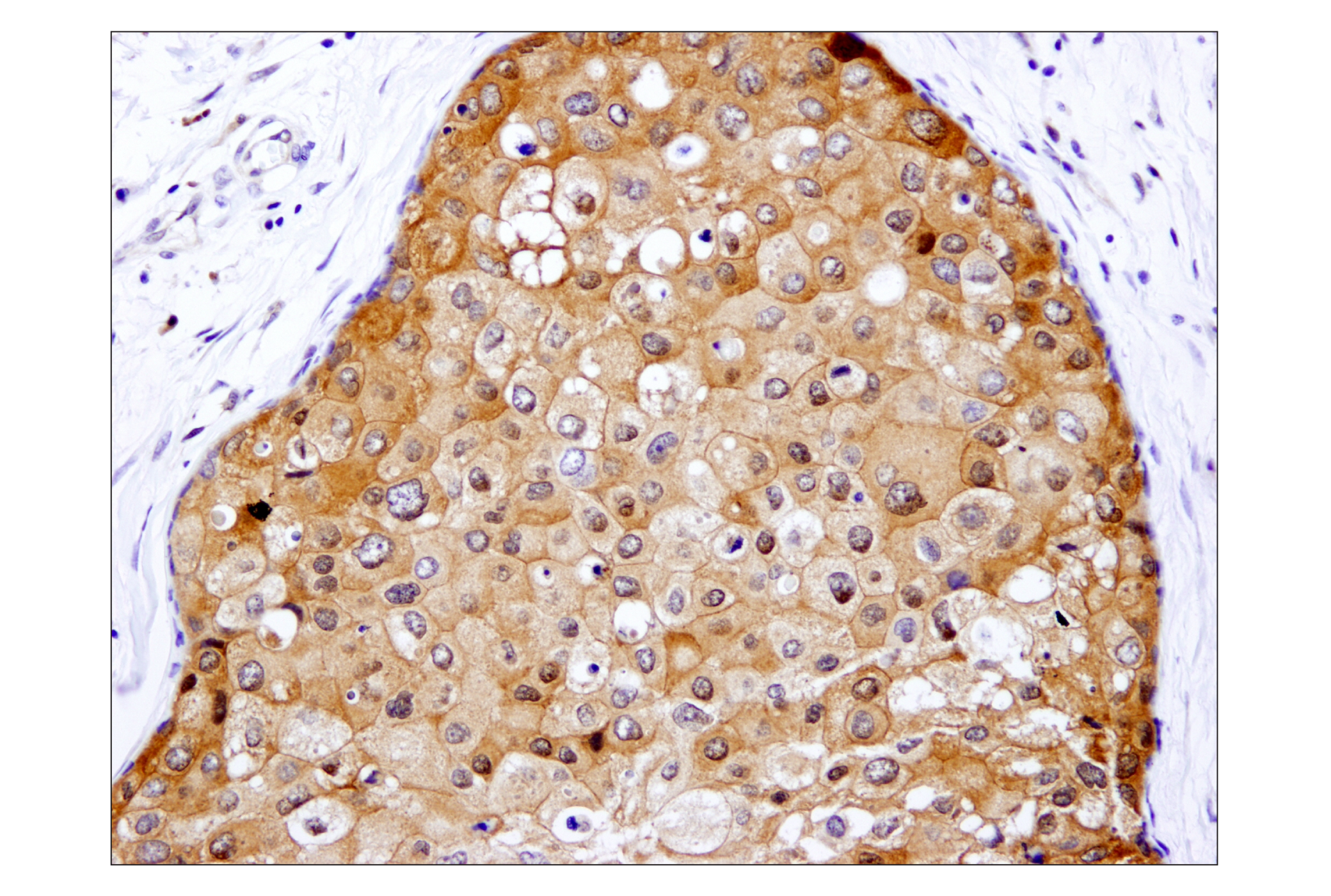 Immunohistochemistry Image 2: Caspase-3 (D3R6Y) Rabbit mAb (IHC Formulated)