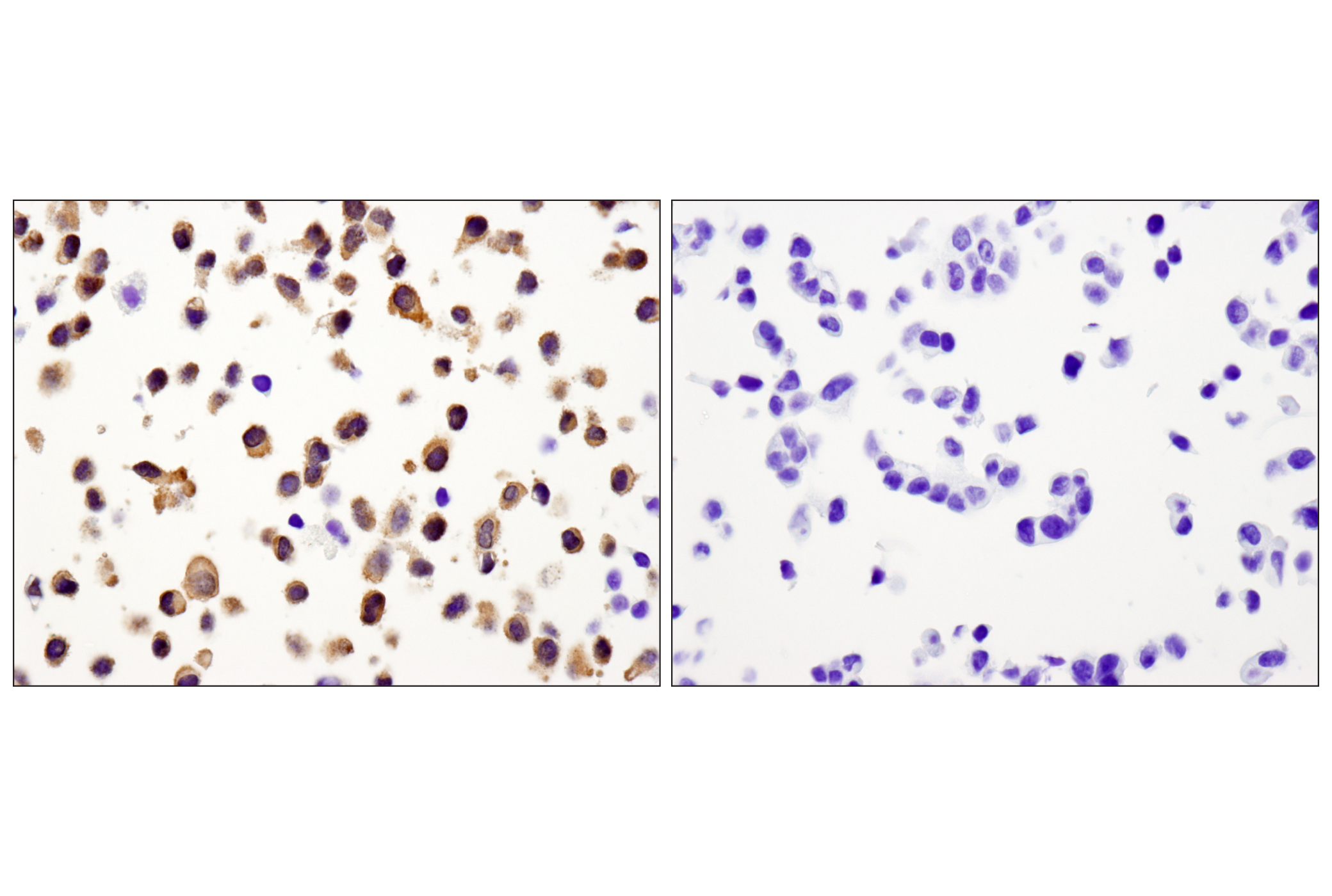 Immunohistochemistry Image 3: Caspase-3 (D3R6Y) Rabbit mAb (IHC Formulated)