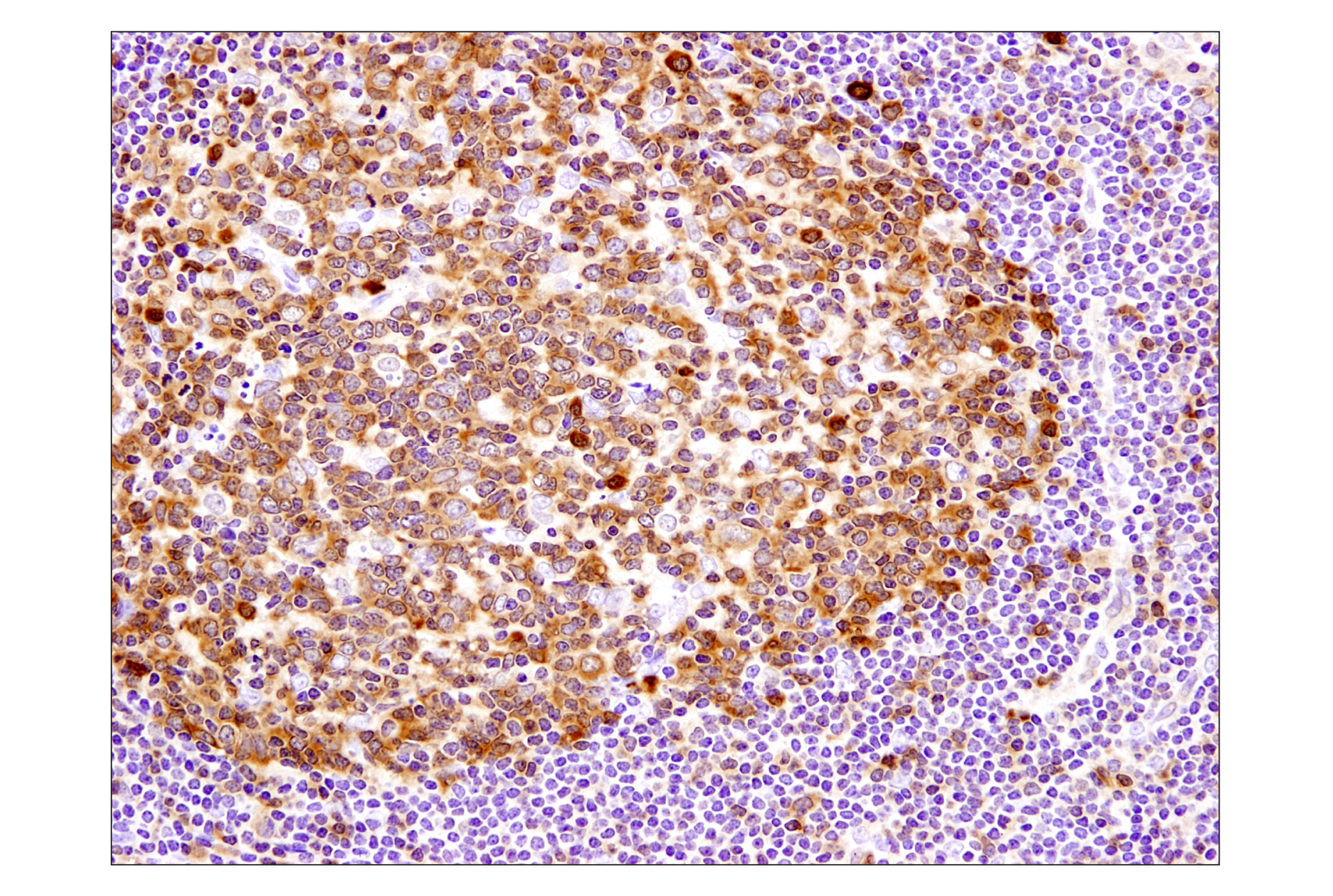 Immunohistochemistry Image 4: Caspase-3 (D3R6Y) Rabbit mAb (IHC Formulated)