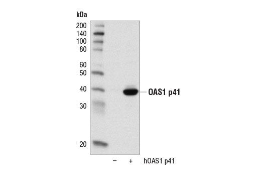 Western Blotting Image 2: OAS1 (D1W3A) Rabbit mAb